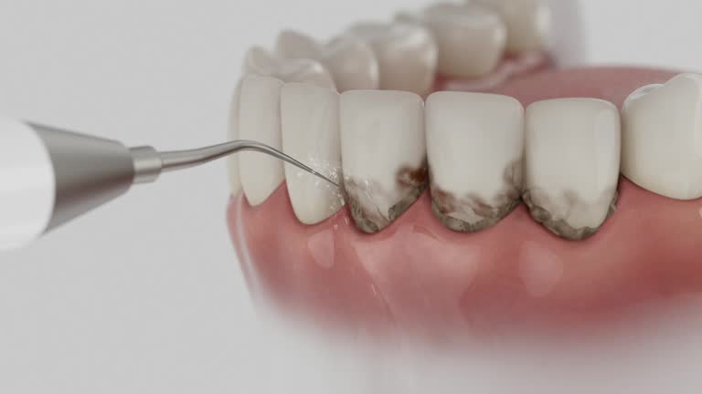 Reliable Teeth Cleaning And Checkup contractor in Champaign County County, OH by Dentist Open Now
